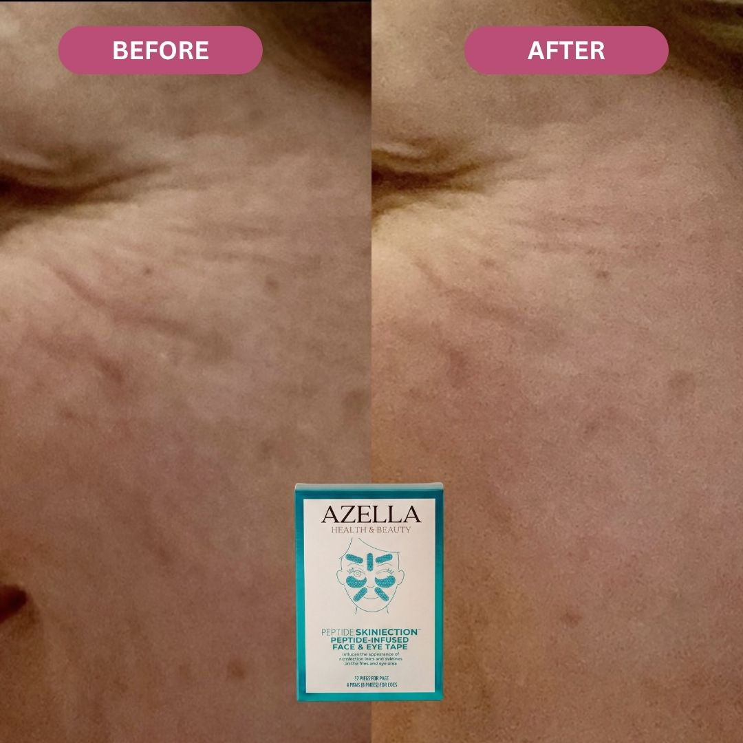 Liftly™ - Peptide Infused Face Tape