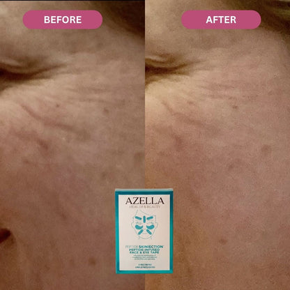Liftly™ - Peptide Infused Face Tape