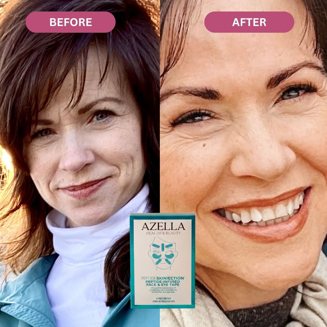 Liftly™ - Peptide Infused Face Tape