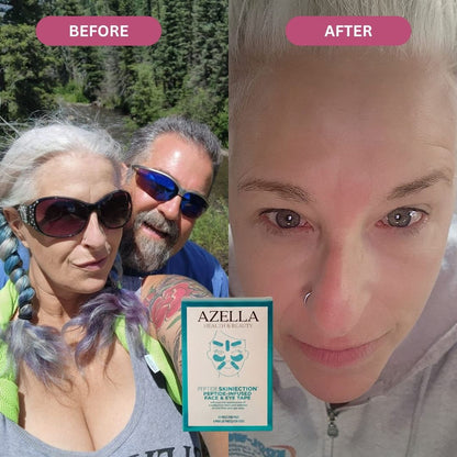 Liftly™ - Peptide Infused Face Tape