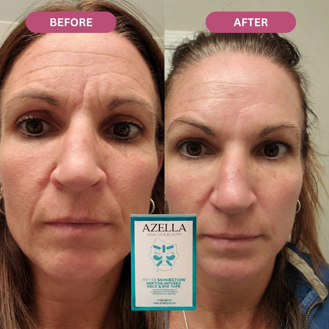 Liftly™ - Peptide Infused Face Tape